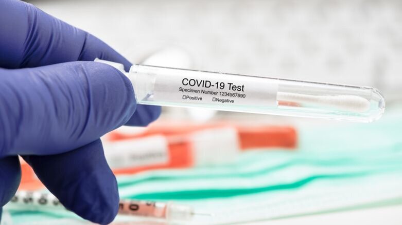 Laten testen bij milde klachten