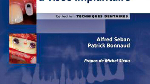 Nouveauté : Le bilan préopératoire à visée implantaire