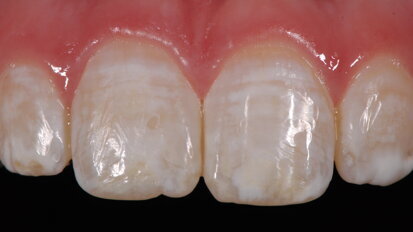 La importancia del pH en los agentes aclaradores