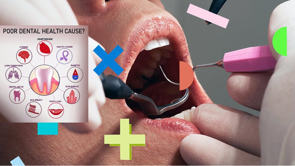 Oral ailments may affect cognitive health, warn experts