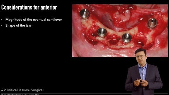 Nobel Biocare представя безплатен онлайн курс за системата All-on-4