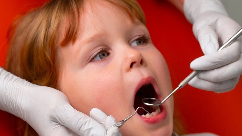 Walka z próchnicą wśród dzieci jednym z priorytetów Rady ds. Rozwoju Stomatologii