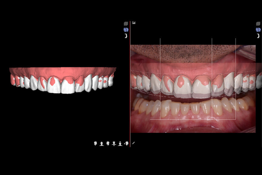 Fig. 9: DSD planning.