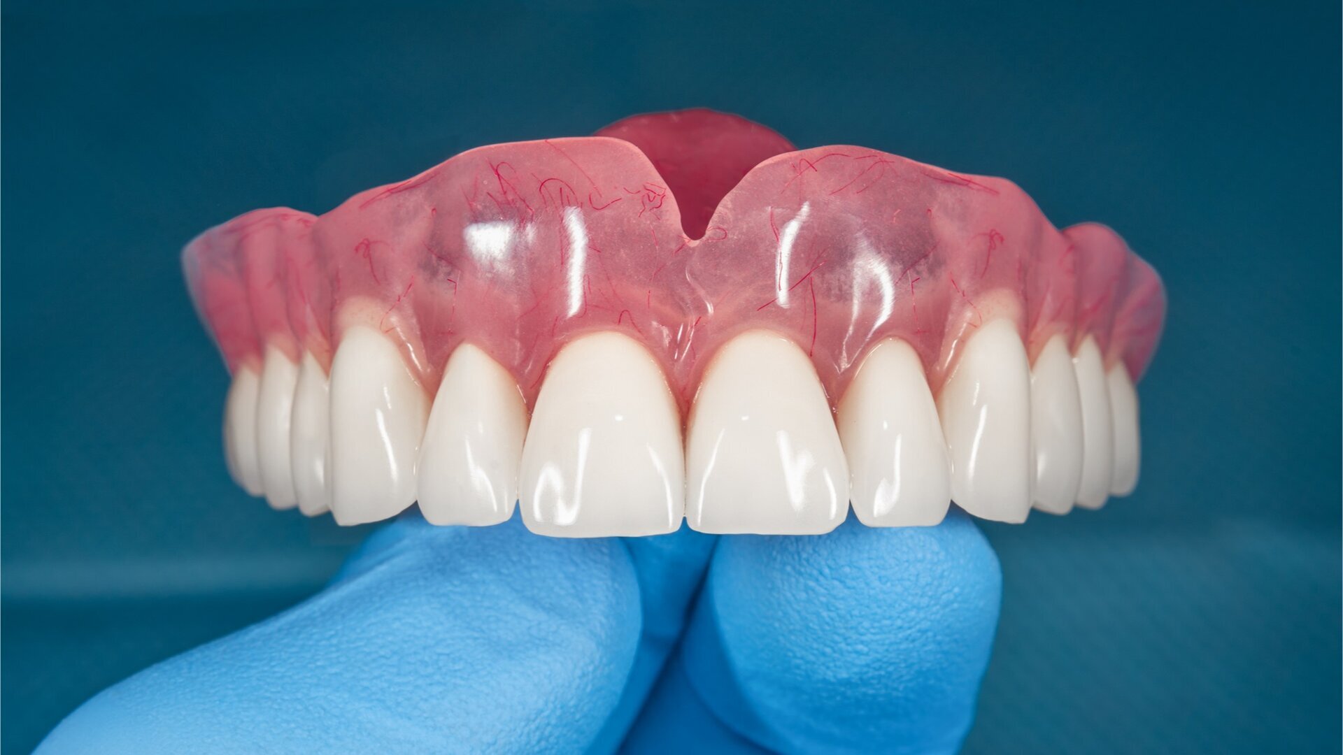 The future is now: Revolutionising dentistry with digital dentures