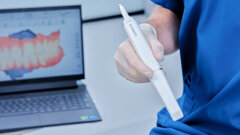 SHINING 3D Dental launches Aoralscan Elf intra-oral scanner