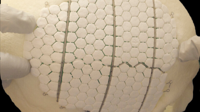 Bioceramic implant induces cranial regrowth and restores bone defects in oral cavity