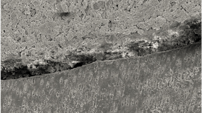 El sellado del complejo dentinopulpar (Primera parte)