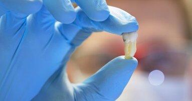 Dentista remove muitos dentes: ação judicial para compensação