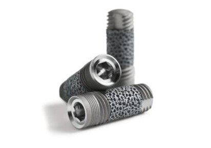 Trabecular Metal Implant – trzeci wymiar implantów stomatologicznych