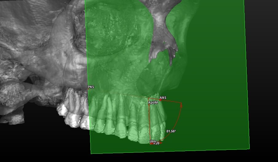Fig. 8_Valutazione della componente dentale in visione para-frontale.