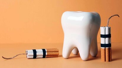 Mundkrebs und Implantat-Verlust durch Tabakkonsum Mundkrebs und Implantat-Verlust durch Tabakkonsum