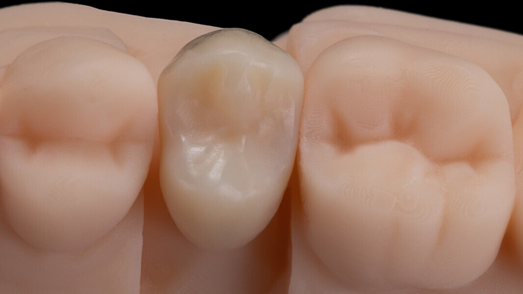 Fig. 9: The accuracy of fit and the warm colour effect in this pure state were convincing.