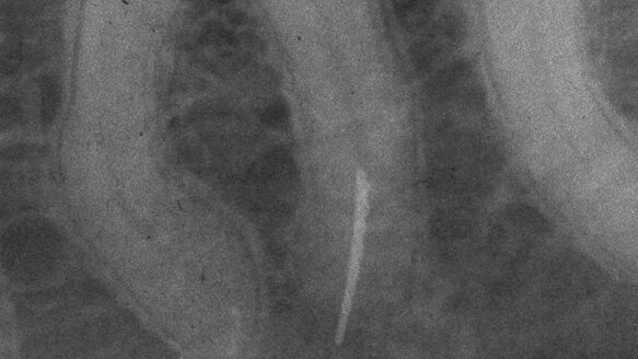 A critical assessment of endodontic armamentarium