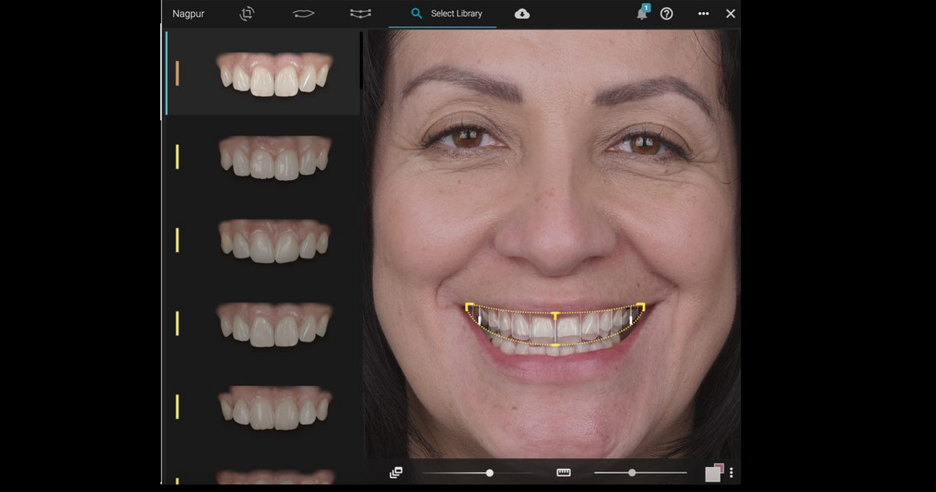 Fig. 2: Digital smile using the Smilecloud Biometrics system.