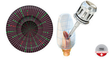 TRI präsentiert das erste digitale Implantat der Welt