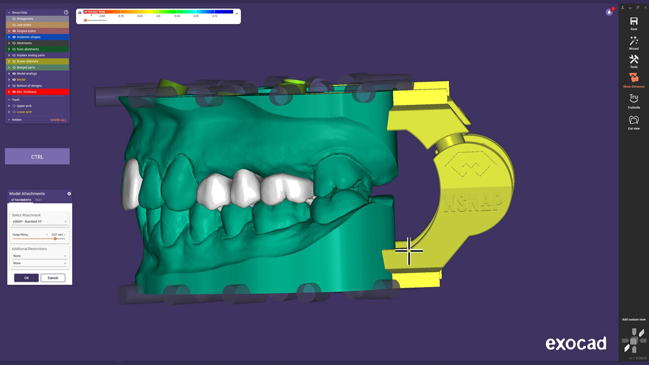 The new xSnap module. 