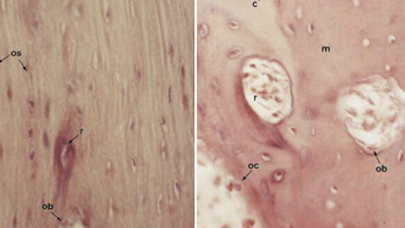 The effects of over-the-counter analgesics on orthodontic tooth movement