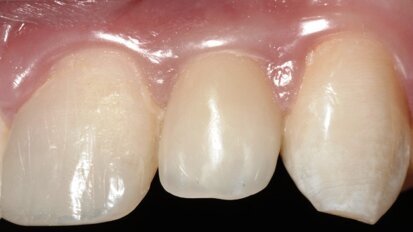 Model oparty na prostocie