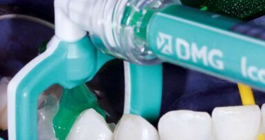 Τρόχισμα με ...τζελ