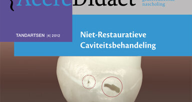 Kinderen met cariës gebaat bij NRC