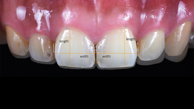 Short cut in the digital fast track
