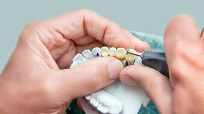 Verband medizinischer Fachberufe e.V. zur „Initiative Zahntechnik“ Verband medizinischer Fachberufe e.V. zur „Initiative Zahntechnik“