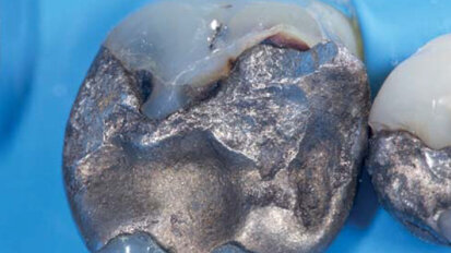 Améliorer vos diagnostics : Que peut-nous apprendre la fluorescence photo-induite ?