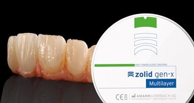 Circonio con transición cromática