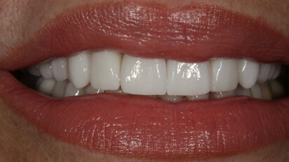 Intégration de la conception numérique du sourire