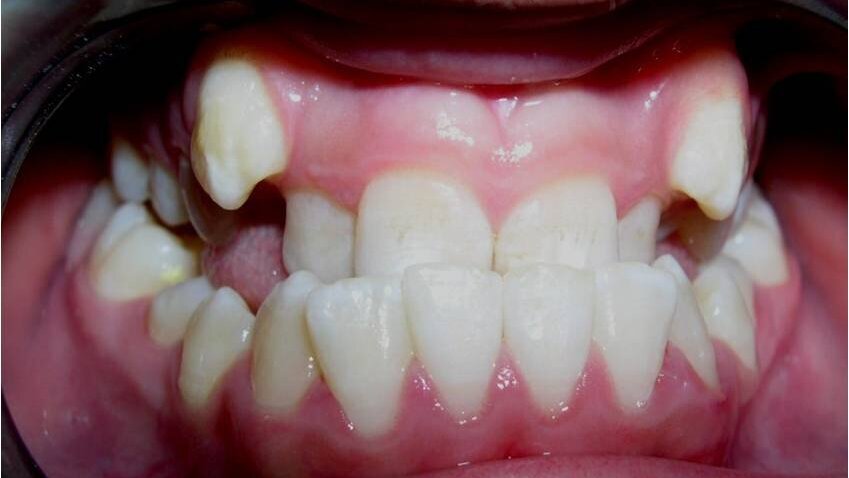 El Sistema Damon o la evolución de la especialidad