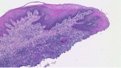 Evaluation of an ex vivo porcine model to  investigate the effect of low abrasive airpolishing