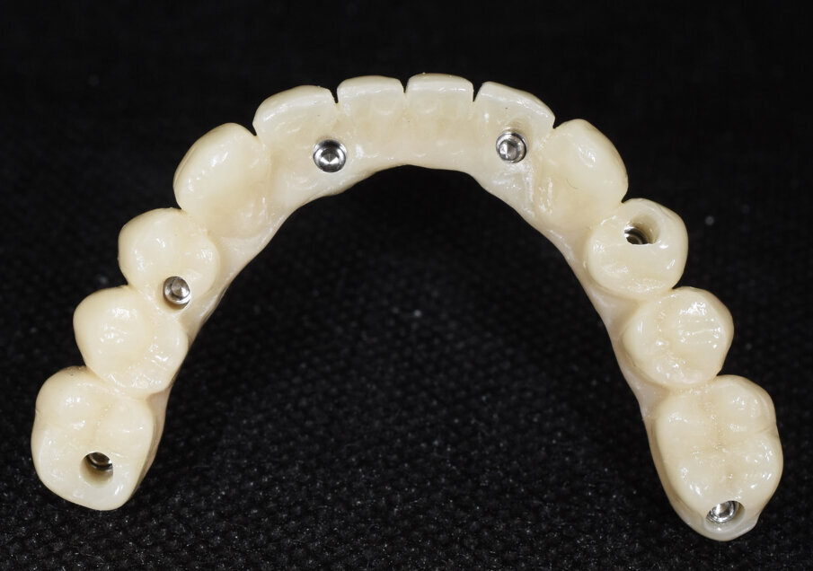 Fig. 18 - Dettagli del provvisorio.