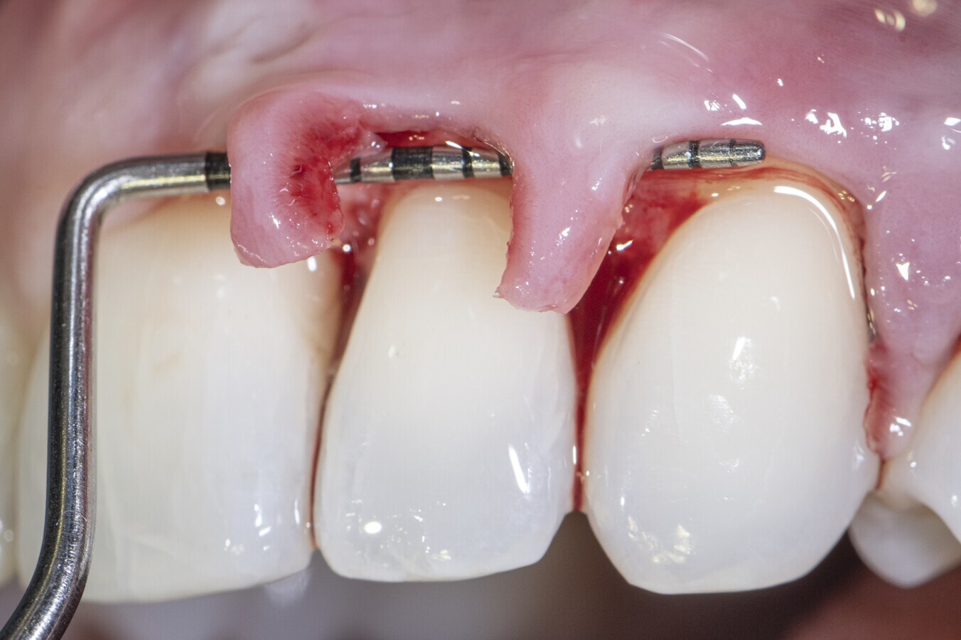 âItâs all about wound healingâ