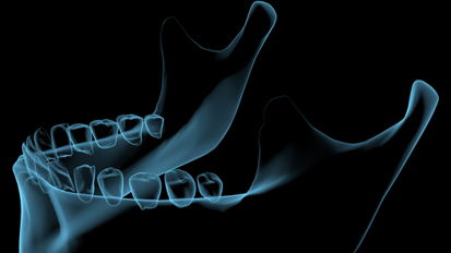Virtuell in Zahn und Kiefer: 7. DDT in Hagen
