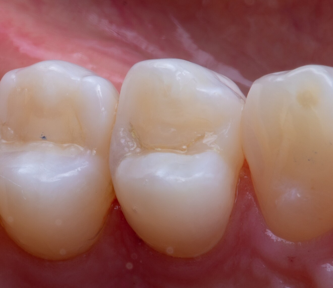 Fig. 1e: Final result. 