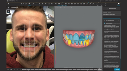 “Patients prefer dentists who take a minimally invasive approach”