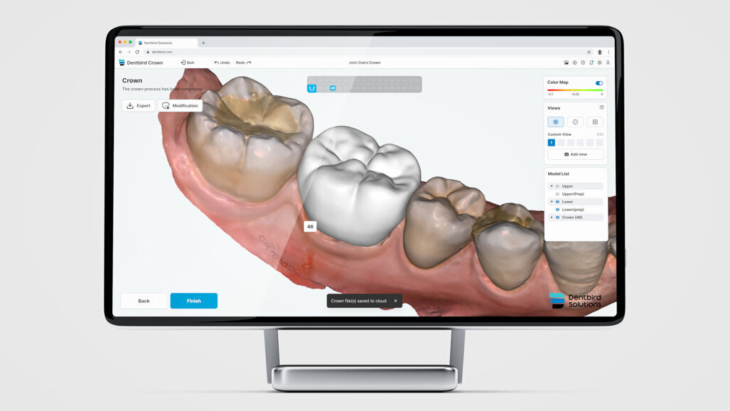 Imagoworks announces distributor agreement with Japanese dental supplier Ci Medical