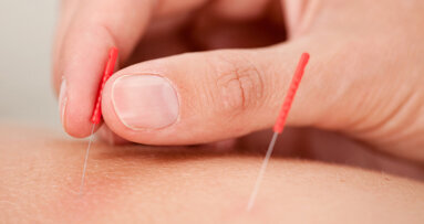 Nadeln gegen Würgereflex bei Abdrucknahme