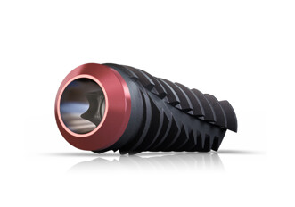 Keystone Dental Group – Genesis Active Conical Implants