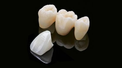 Zirlux FC2 : un système innovant pour des restaurations toujours plus fiables et esthétiques