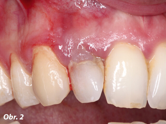 Obr. 2: Klinický obrázek iniciální situace