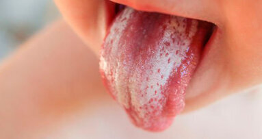 Nuove sostanze per il controllo delle risposte infiammatorie provocate da infezioni fungine