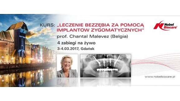 „Leczenie bezzębia za pomocą implantów zygomatycznych” – praktyczny kurs dla lekarzy dentystów