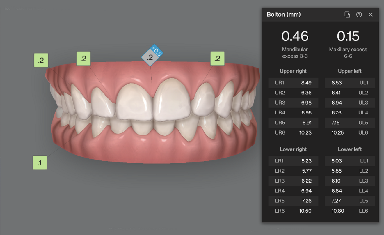 Fig. 5: Bolton’s analysis table depicting tooth size discrepancy.