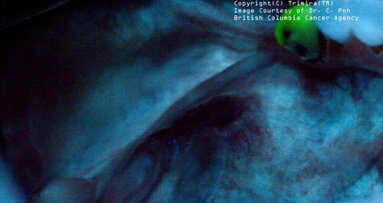 Trimira offers oral cancer images online