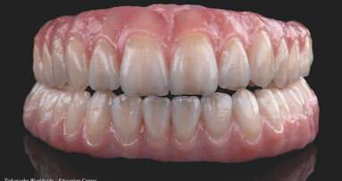Zirconia hecha con orgullo