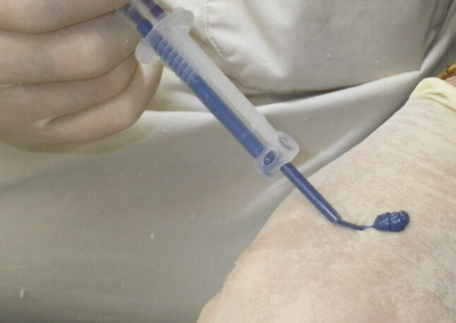 Fig. 9: The 3M™ Intra-oral Syringe is activated and must be bled before using for final impression.