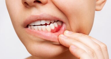 Tackling multi-morbidity in the dental practice: NSK Academy webinar to focus on lifestyle medicine