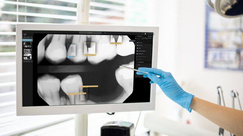 Second Opinion, please: AI-assisted dental radiology tool approved for Australia and New Zealand