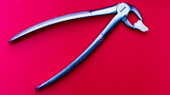 Falscher Zahnarzt praktiziert ohne Lizenz und Betäubung